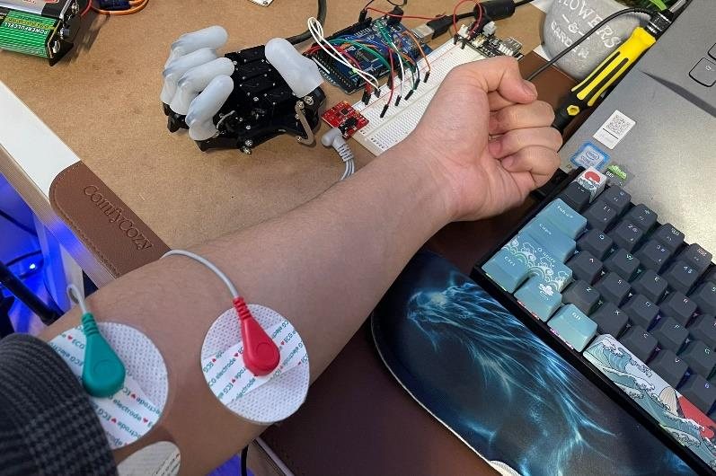 A user opening and closing the hand by flexing forearm muscles with electrodes attached